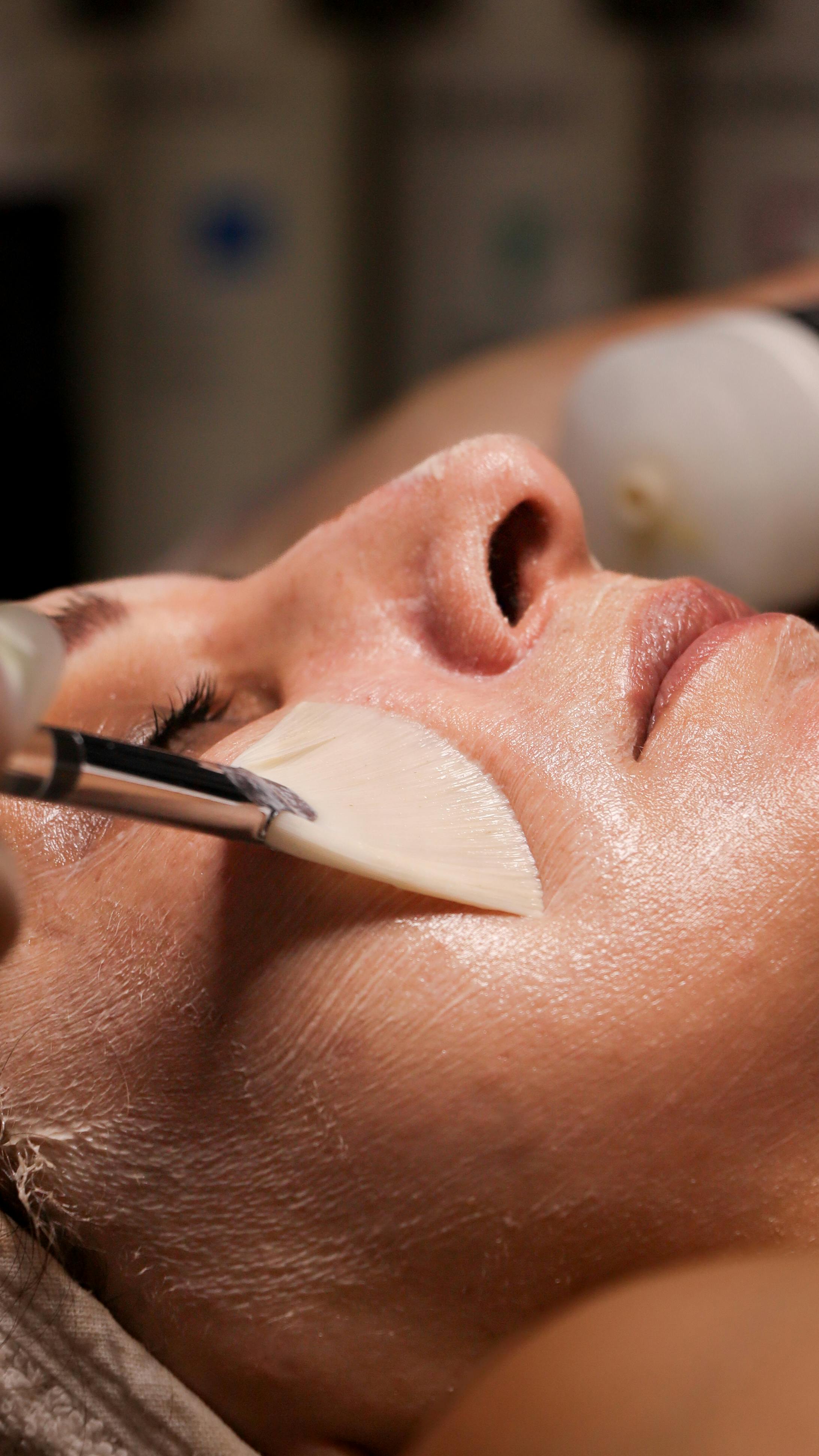 Advanced facial and chemical peel treatment at The Beauty Spot, Tonbridge
