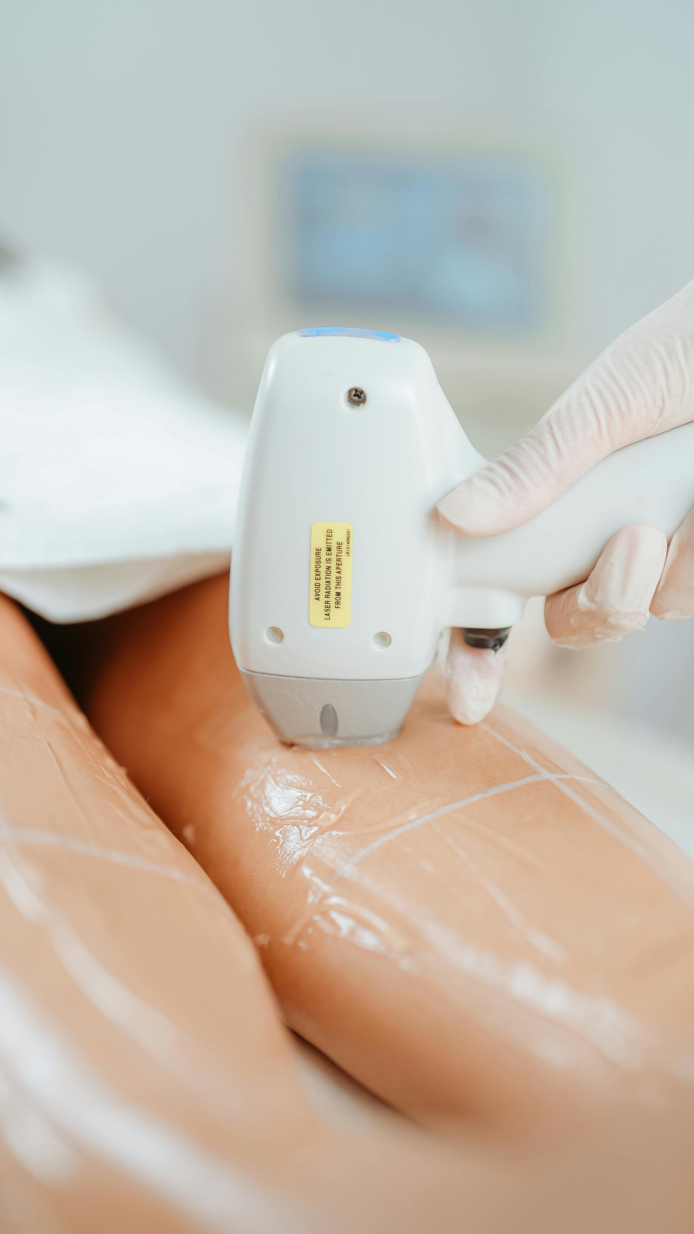 7D HIFU skin tightening treatment at The Beauty Spot, Tonbridge