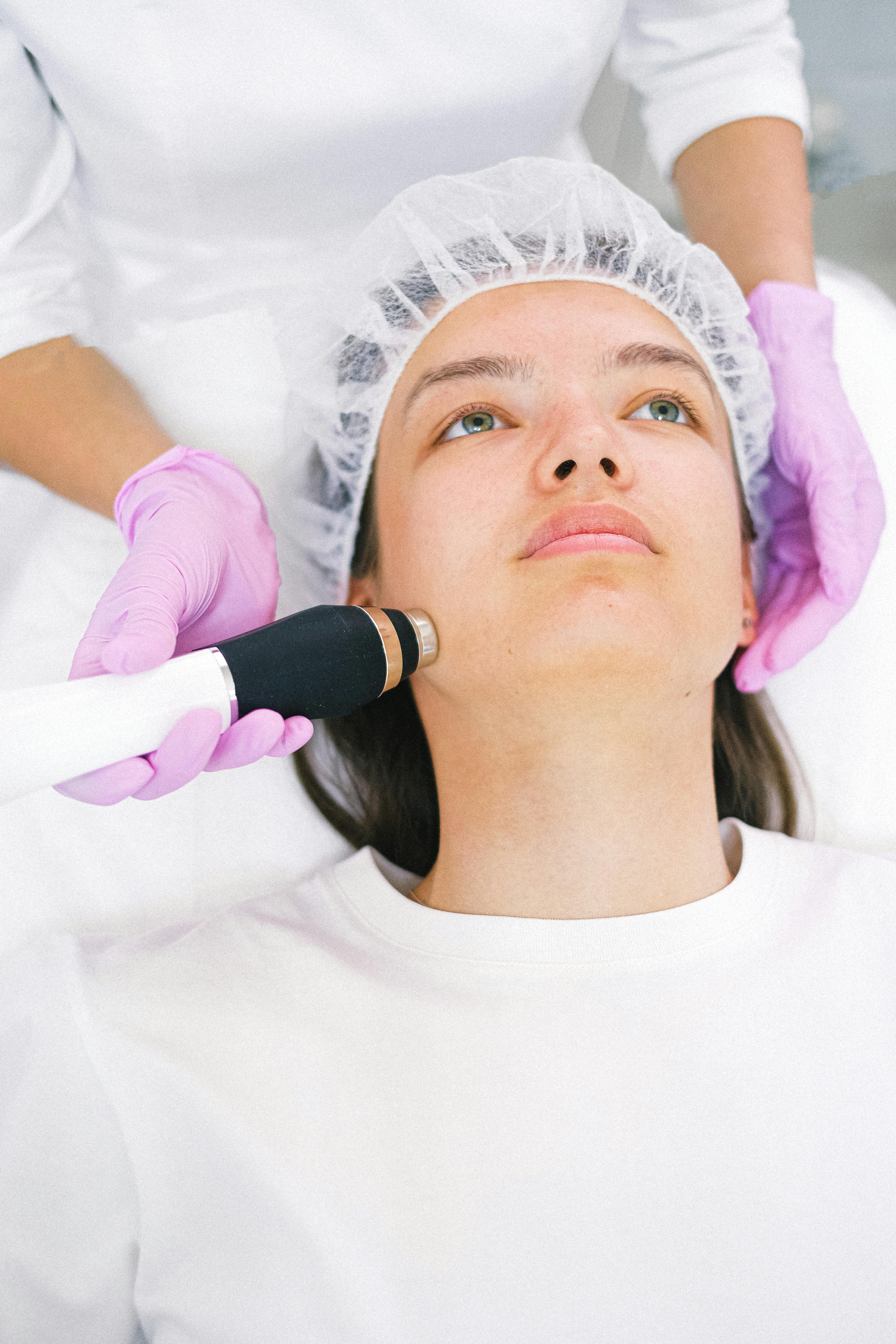 RF Microneedling treatment at The Beauty Spot, Tonbridge