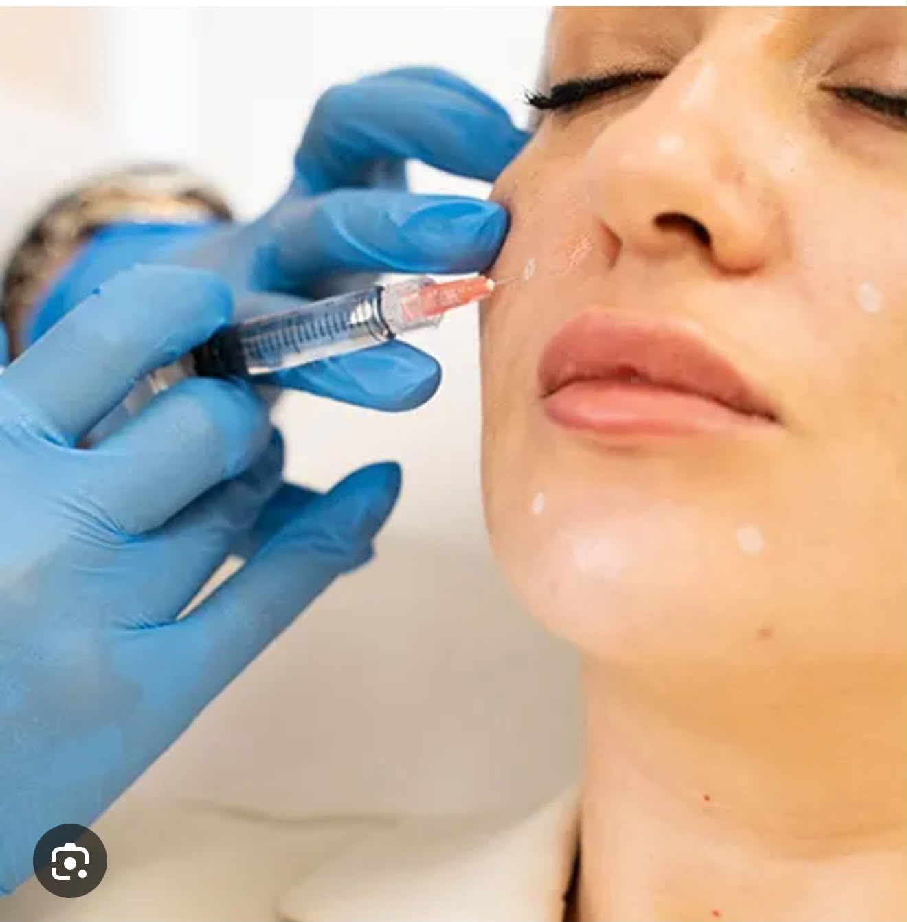 Skin booster injection treatment at The Beauty Spot, Tonbridge